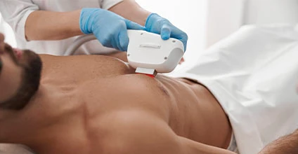 Depilación láser y foto depilación