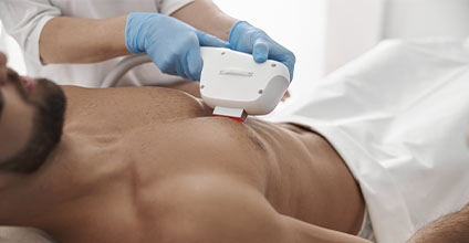 depilacion-laser-y-fotodepilacion